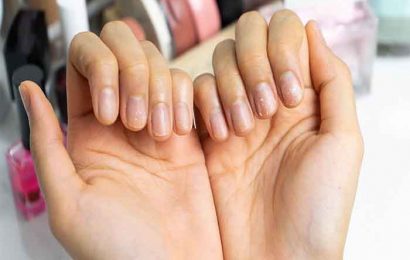 How to treat brittle nails?