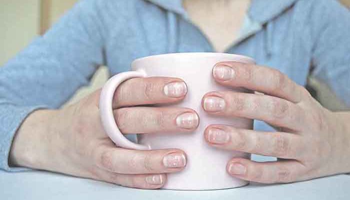 How to get rid of white spots on nails?