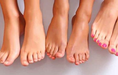 Yellow toenail: Treatment and Prevention